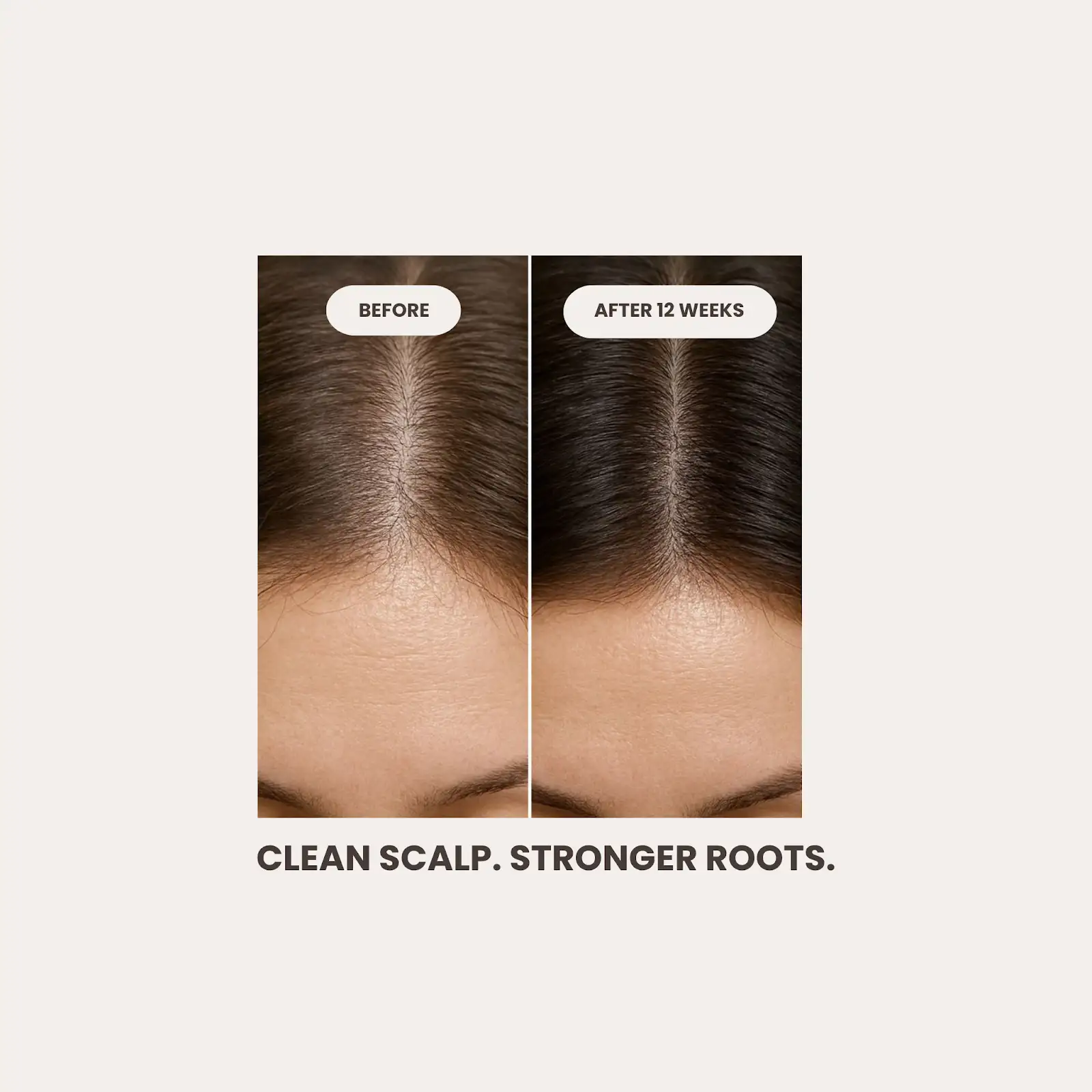 Metoblend Shampoo - 150g